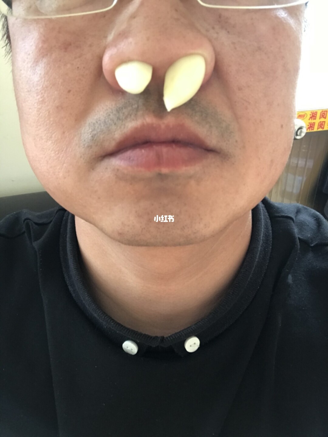 鱼腥草治鼻窦炎的偏方_治疗鼻窦炎的偏方大全_鼻窦炎偏方