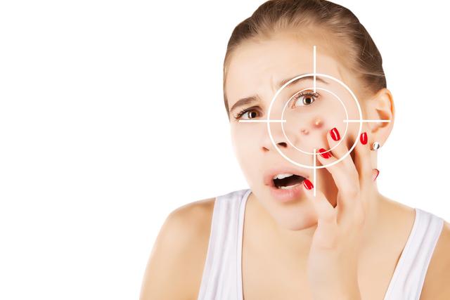 痤疮的最佳治疗方法