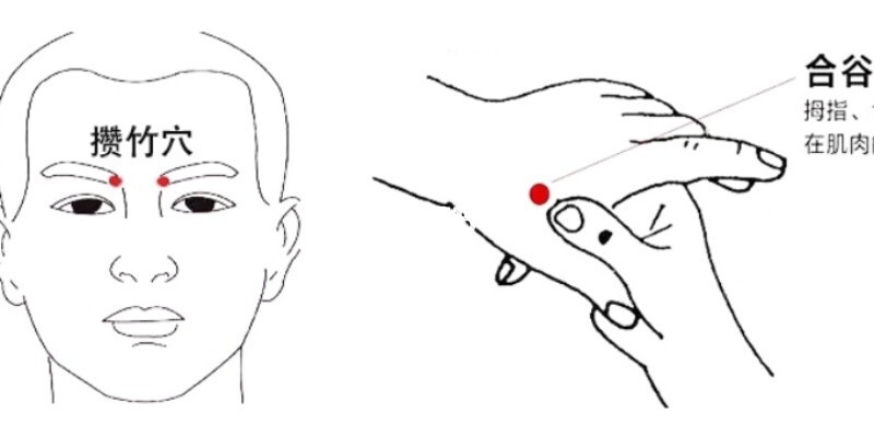 丛集性头痛有什么偏方_头痛治疗偏方_治头痛偏方