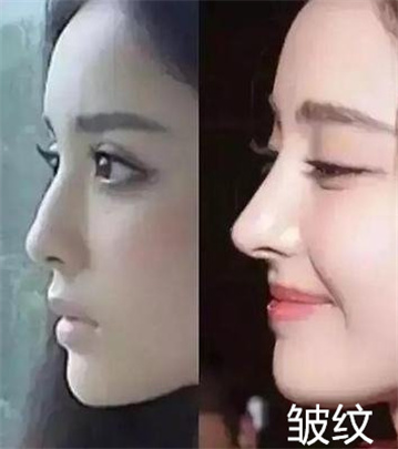 排毒养颜祛痘祛斑中药方-排毒祛痘中药配方(2022推荐) 排毒养颜祛痘祛斑中药方