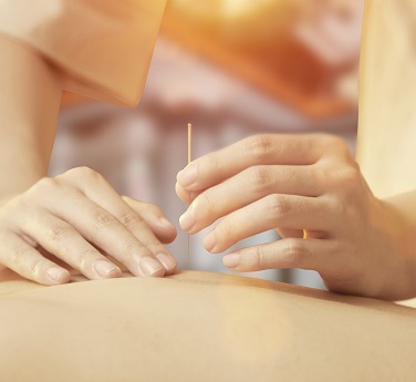 针灸