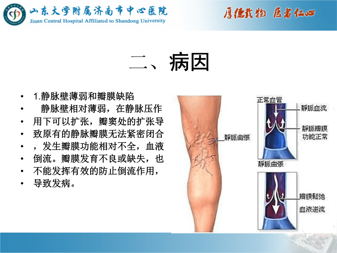 香港必理痛特效副作用_腰腿神经性痛疼怎么办_经方特效腰腿痛方