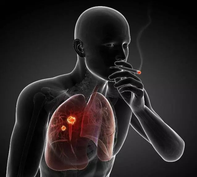 肺癌晚期中药偏方_肺癌晚期治疗偏方_治肺癌晚期症偏方