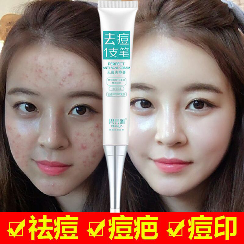 吃什么药祛痘最快 治痘偏方