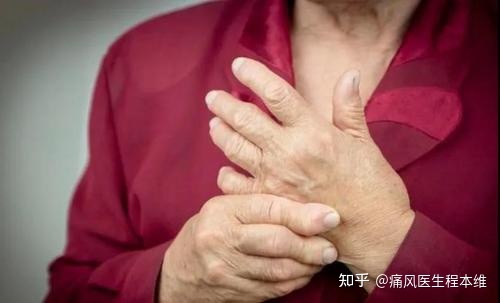 得了类风湿关节炎?几招教你自我治疗 风湿关节痛的偏方_左肩粘连性关节囊炎_类风湿性关节炎偏方