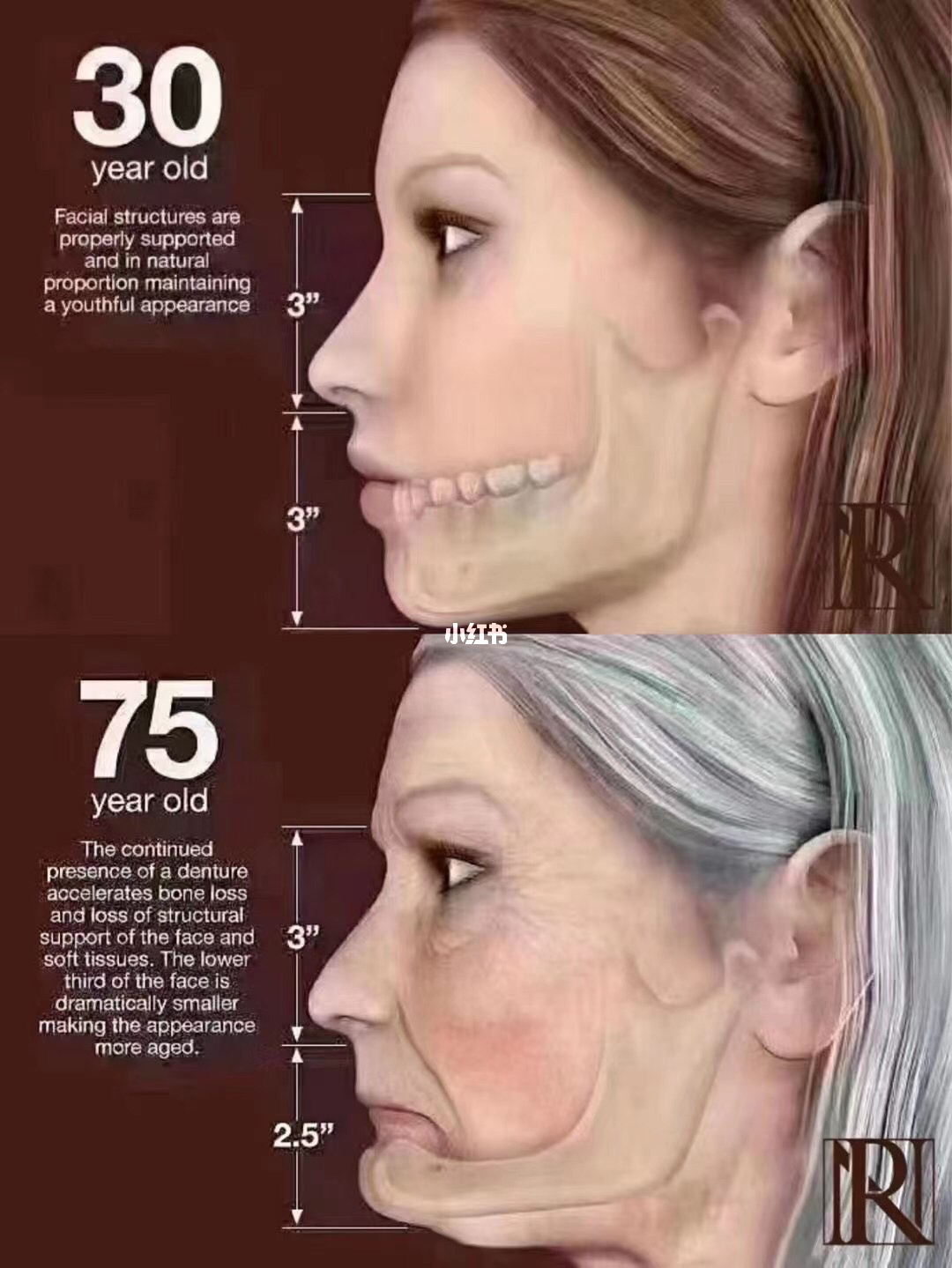 女人抗衰老的秘方_24岁可以用抗衰老产品吗_安利抗衰老产品