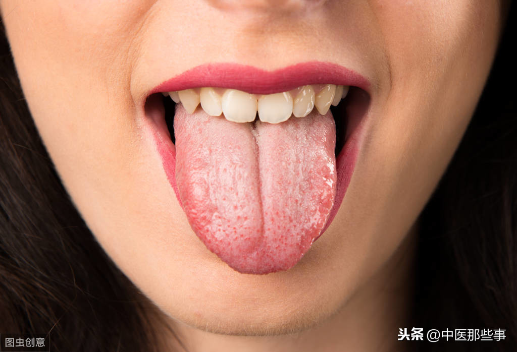 舌苔厚腻，肠胃经常湿热？如果这些症状都占，无疑是“湿热体质”