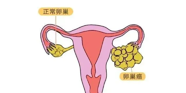 内分泌失调偏方大全_荷尔蒙分泌失调药物_荷尔蒙分泌失调怎么办