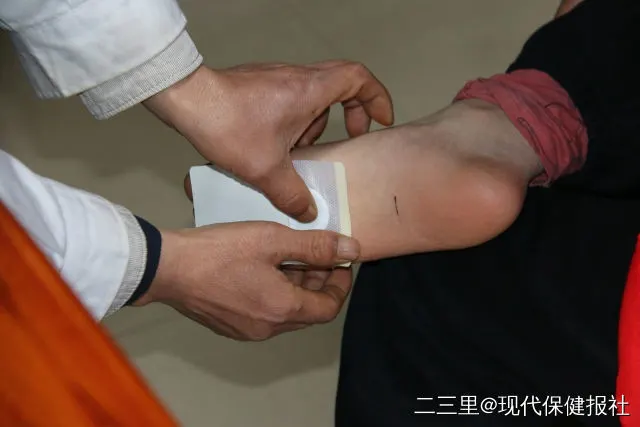 治疗鼻炎的小偏方_蜂蜜治疗急性鼻炎偏方_妊娠期鼻炎治疗小妙招