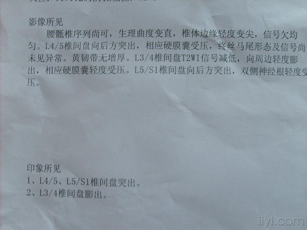 北京哪家医院治颈椎骨质增生好_颈椎骨质轻度增生_颈椎骨质增生偏方