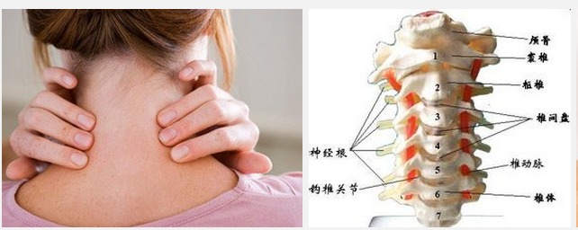 颈椎骨刺增生_颈椎骨质增生偏方_颈椎椎体增生