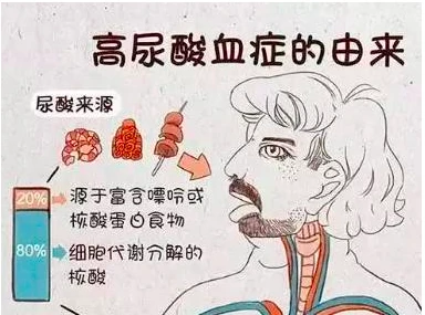 血钙高血磷低,且尿酸高_尿酸高秘方_尿酸高吃什么降尿酸