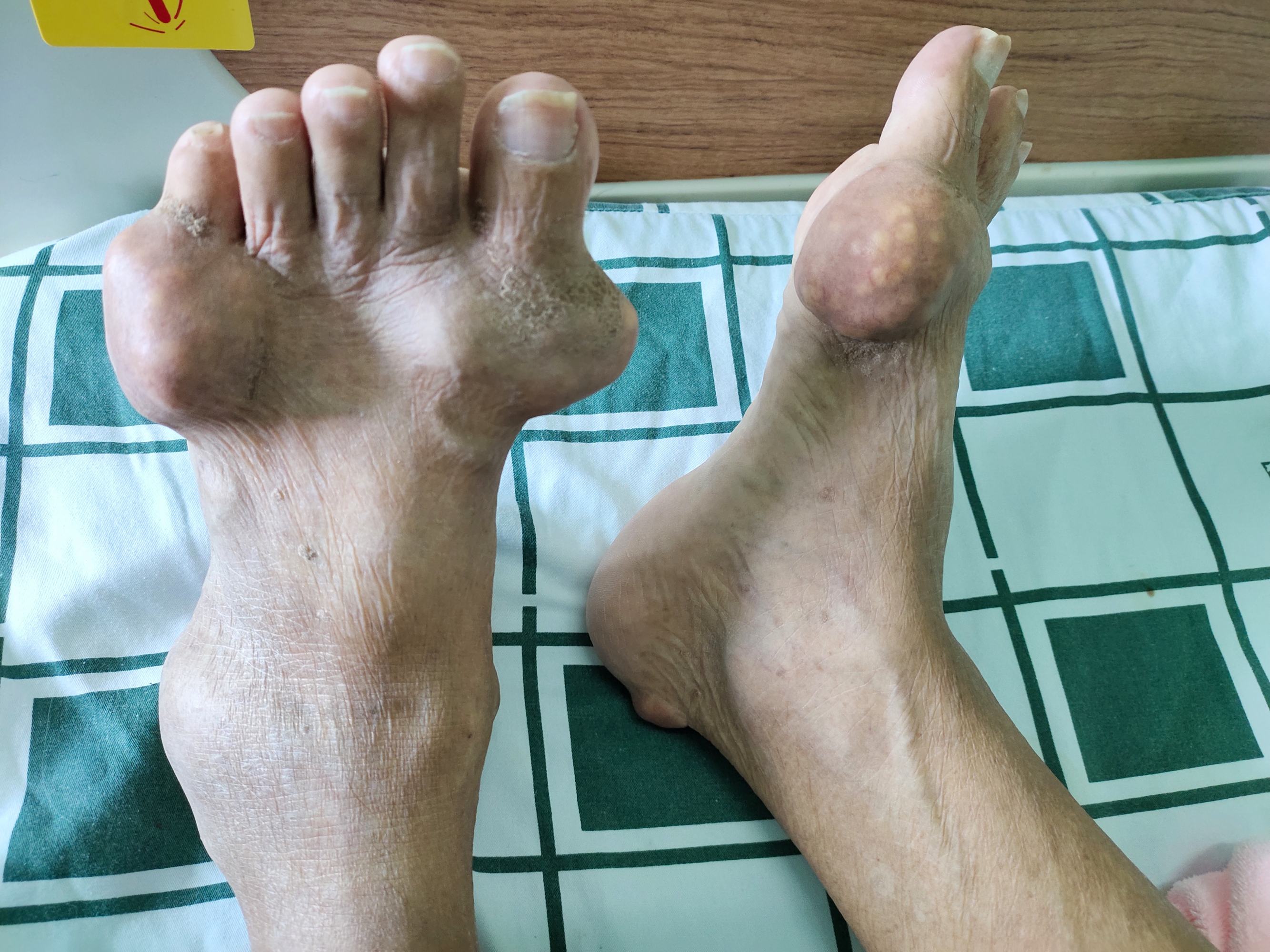 7种缓解身体疼痛的民间偏方推荐 李时珍的偏方和秘方_李时珍的丰胸秘方_李时珍治骨刺秘方