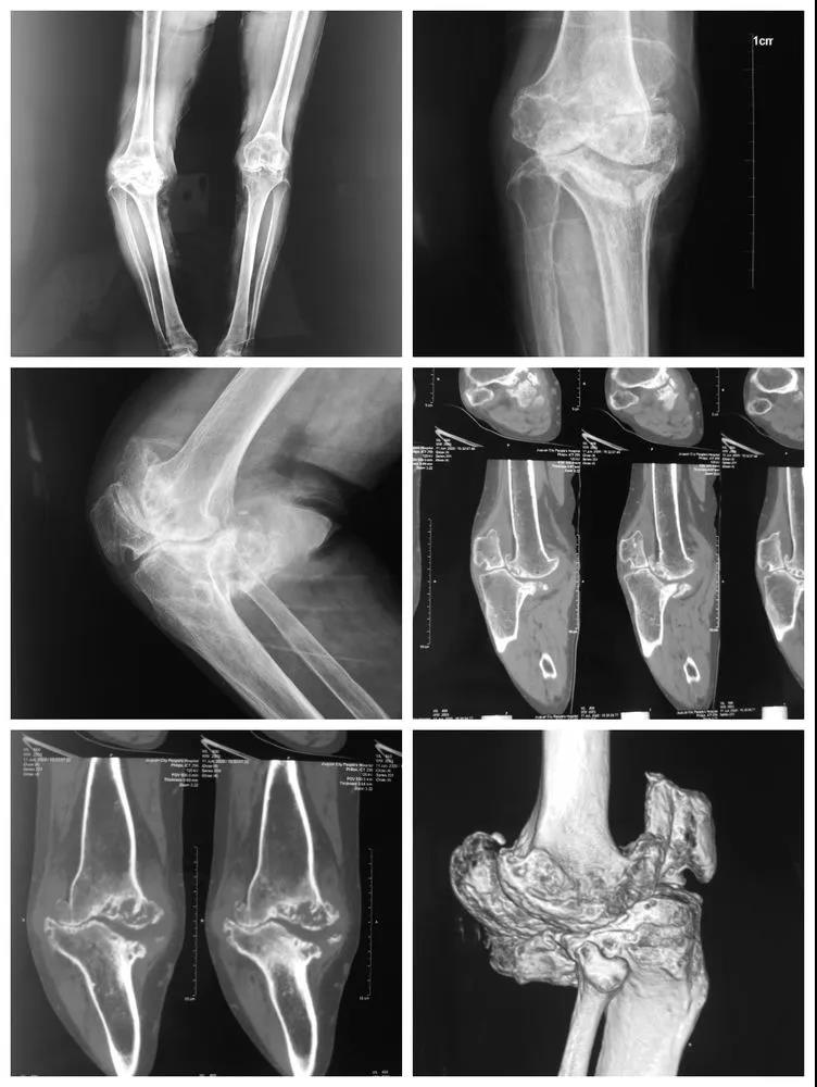 7种缓解身体疼痛的民间偏方推荐 李时珍治骨刺秘方_李时珍的丰胸秘方_李时珍的偏方和秘方