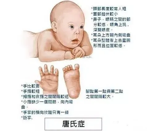 民间秘方专治颈椎病_专治阴囊湿疹秘方_祖传专治烧烫伤秘方