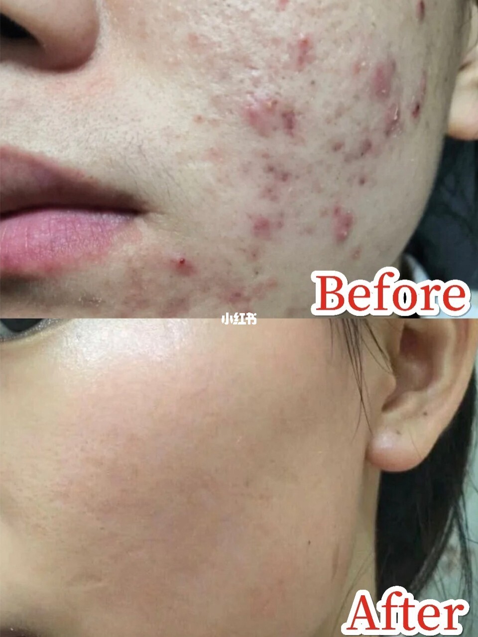 香油祛痘偏方_治咳嗽偏方香油炒鸡蛋_祛痘的偏方