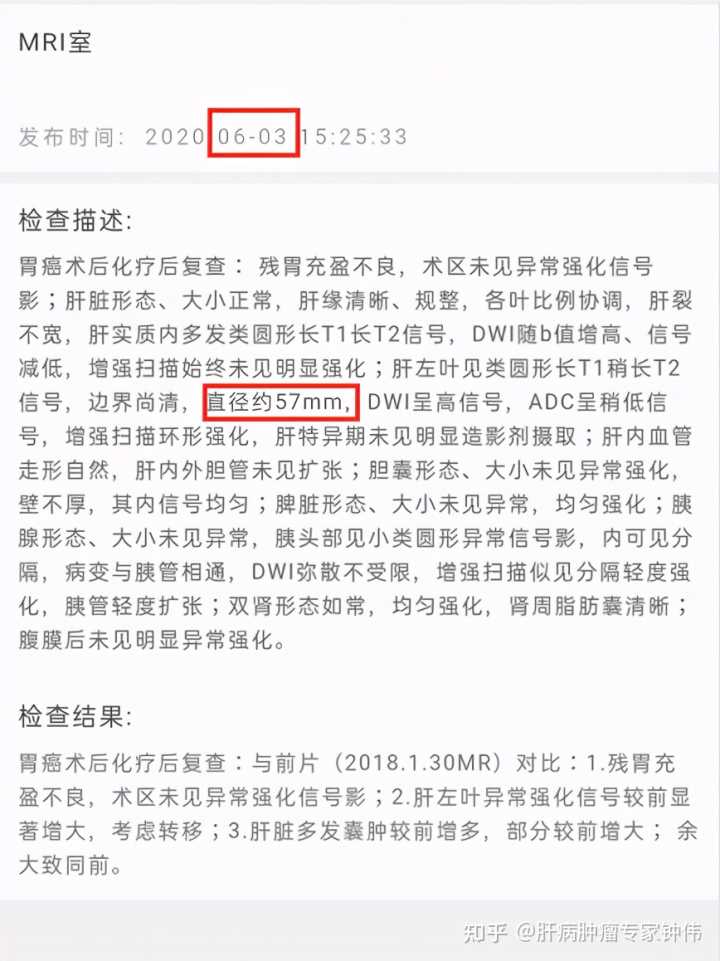 肝癌晚期怎么更好的治疗? 肝癌晚期中药偏方_治疗肝癌晚期的偏方_肝癌晚期症状15大偏方