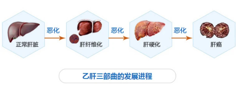 肝病哪里治的最好_治肝病的偏方_治脚气的偏方大全治