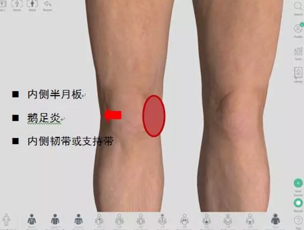 腰椎间盘突出特效断根秘方_中央台腰椎肩盘突出治疗仪_腰椎肩盘突出症