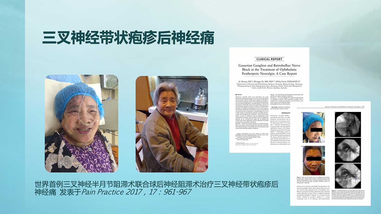 “缠腰蛇”带状疱疹剧痛难忍,该怎么治疗?这4个疗法不少人在用 带状性疱疹 偏方_民间治疗疱疹的偏方_带状疱疹的治疗偏方