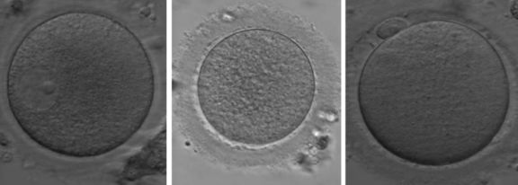 卵受精到着床多少天_卵受精了还会排卵吗_受精卵