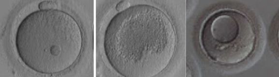 卵受精到着床多少天_受精卵_卵受精了还会排卵吗