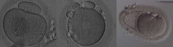 受精卵_卵受精了还会排卵吗_卵受精到着床多少天