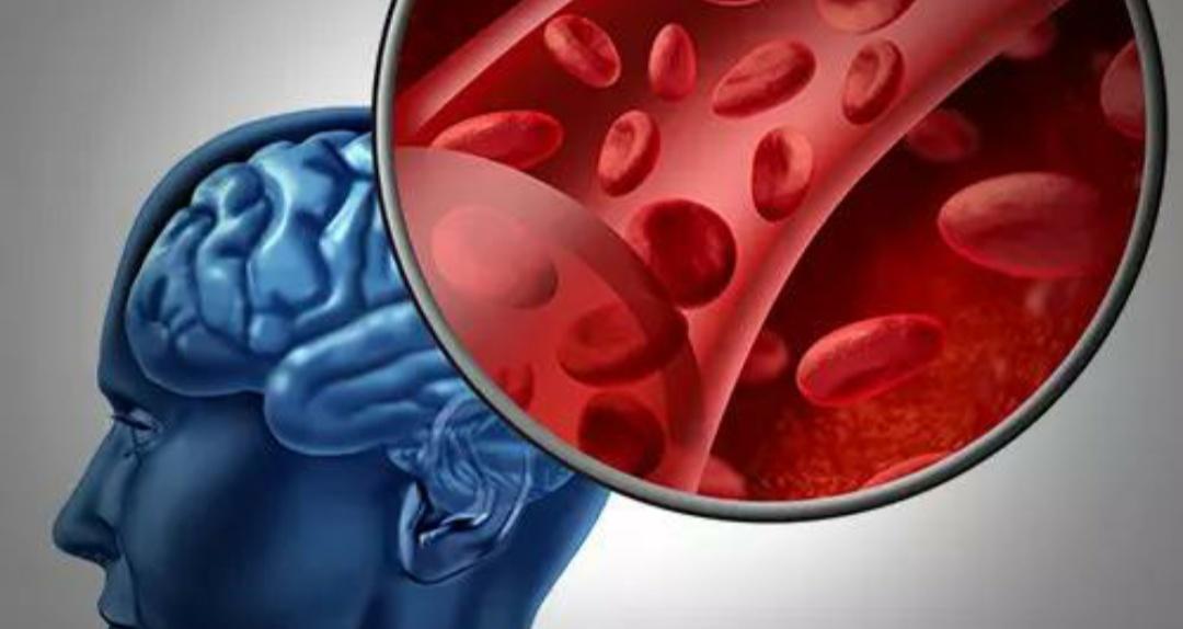 血管瘤毛细血管扩张_血管瘤毛细血管破裂_毛细血管瘤