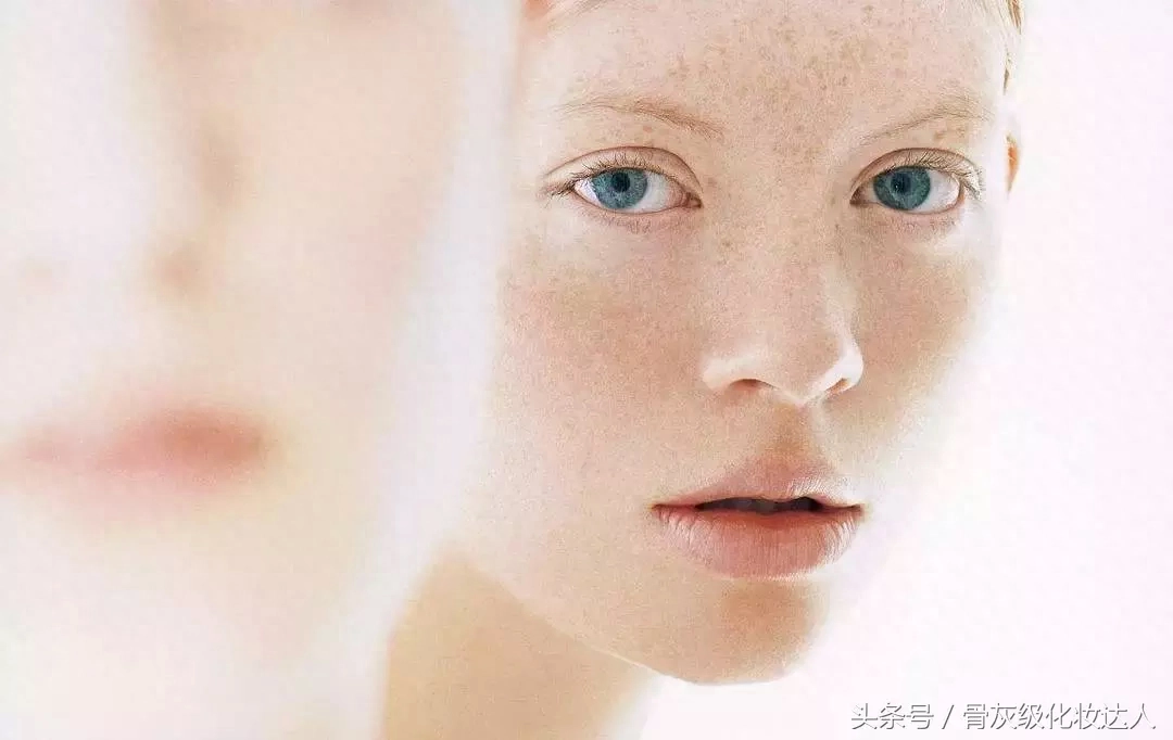 晒斑会自己消退吗_晒斑怎么快速去除_日晒斑