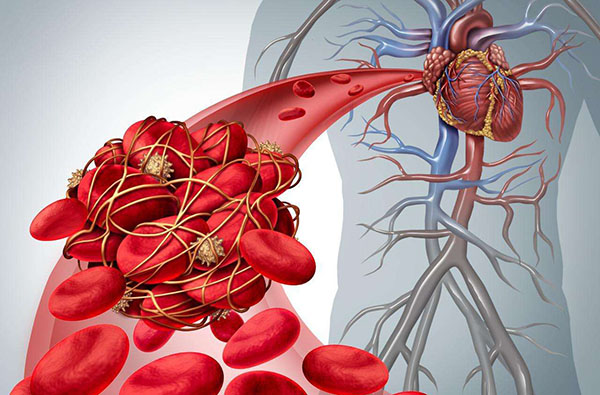 内源性凝血因子有哪些?外源性凝血因子有哪些 内源性凝血因子有哪些?外源性凝血因子有哪些