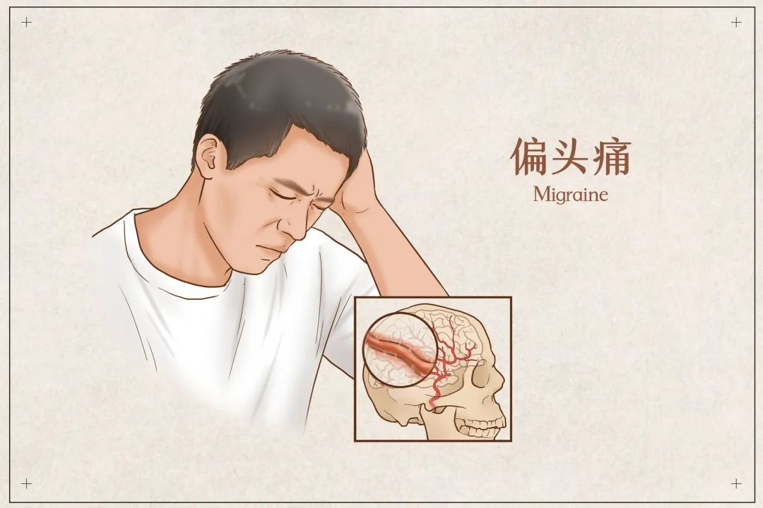 1分钟治疗头痛简易方法_头痛土方法_月经期间头痛恶心缓解方法