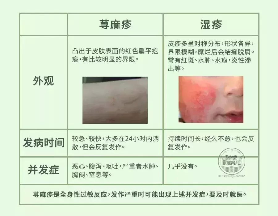 哮喘断根秘方_胃病断根绝技秘方_祖传荨麻疹断根秘方