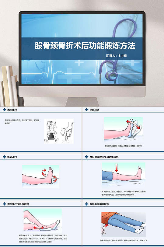 骨折踝关节间隙变宽怎样恢复_骨折踝关节背屈受限锻炼方法_三踝骨折
