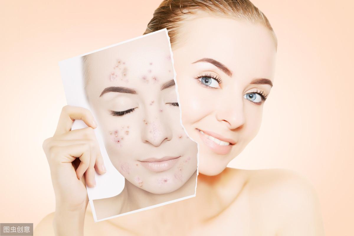 酸杏仁的功效与作用禁忌_酸杏仁能治失眠吗_杏仁酸