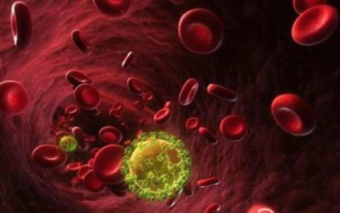 艾滋病的传播途径是_艾滋_艾滋病感染症状