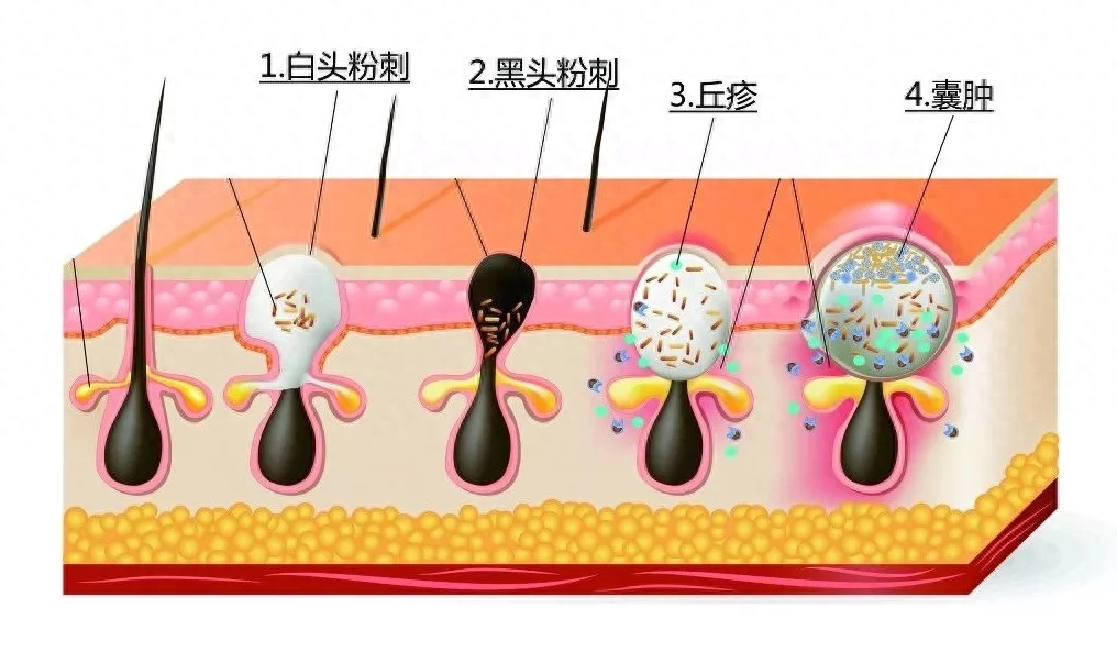 酸杏仁的功效与作用禁忌_酸杏仁粉的功效和作用是什么_杏仁酸