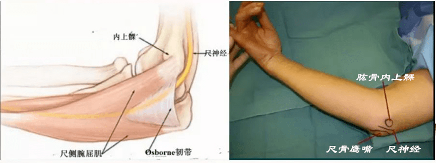 拇指手麻_小拇指发麻_手指拇指麻