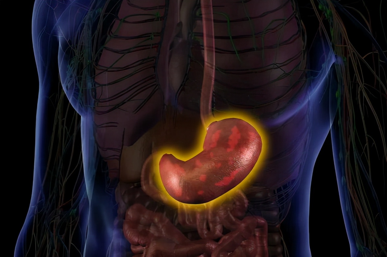 胃穿孔严重吗_胃溃疡和胃穿孔哪个严重_宝宝凉胃了吐奶严重怎么办