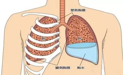 纤维肺 北京永安哮喘_两肺纤维增殖灶_老年人肺纤维化