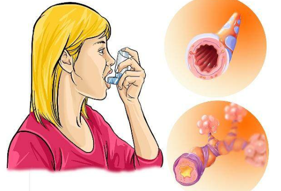 咳嗽治疗偏方有哪些_治咳嗽的偏方有哪些_治疗反复咳嗽的偏方