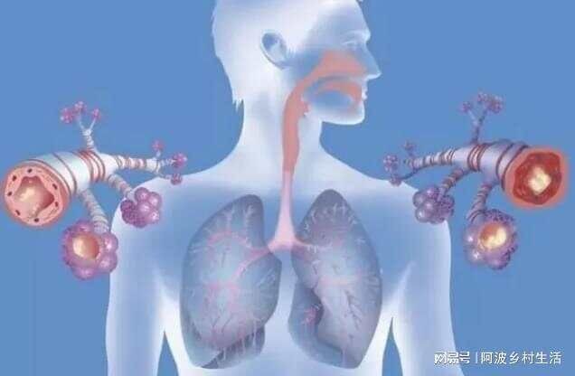 _肺磨玻璃怎么治疗可以消失_肺磨玻璃是怎么回事