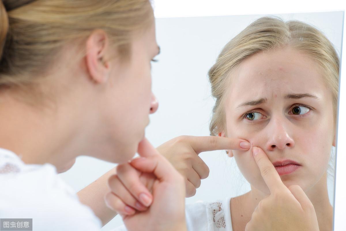 头皮长痘痘_痘痘长头皮上_痘痘长头皮上会秃吗