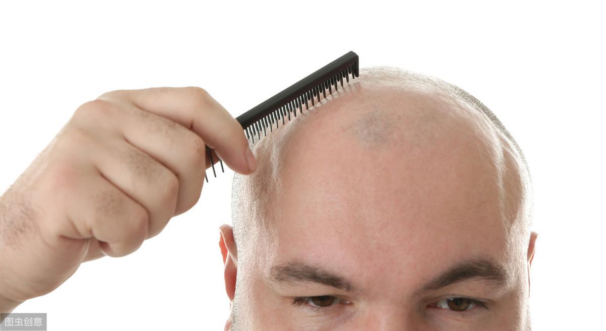 痘痘长头皮上_痘痘长头皮上会秃吗_头皮长痘痘