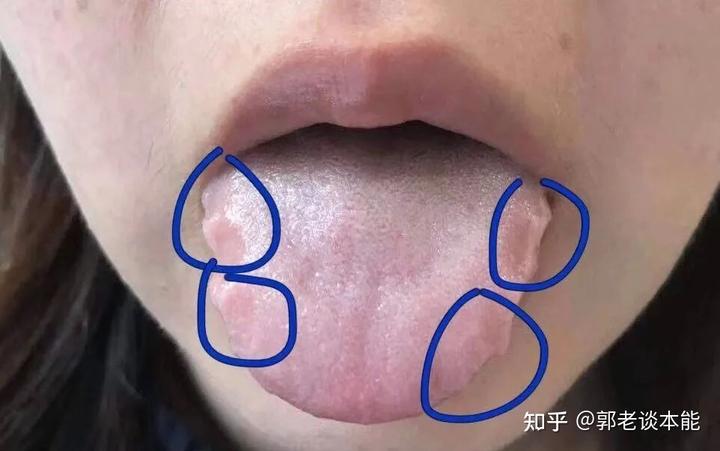 燥湿化痰中药_燥湿_燥湿化痰是什么意思